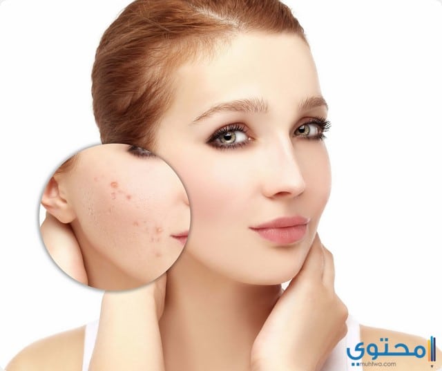 دواعي استخدام دواء أدابالين