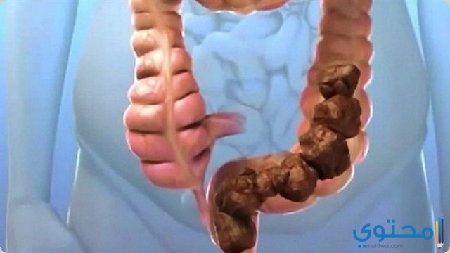 اسماء ادوية لعلاج الامساك