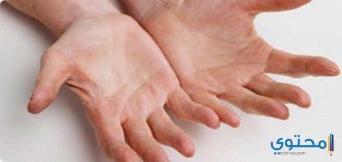 أسباب تشقق اليدين