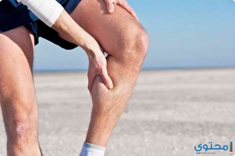 أعشاب آخري لعلاج دوالي الساقين