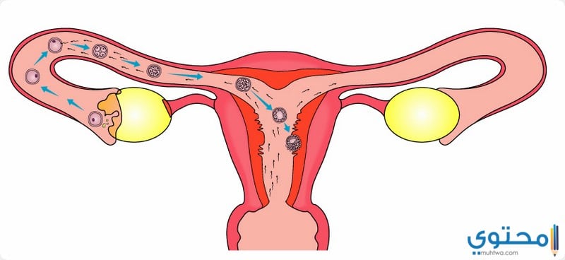 حالات خضعت لعمليات زراعة الرحم