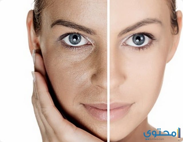 دواعي استخدام كريم سبوتلس