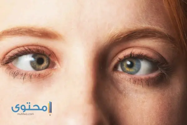 أمراض العيون وعلاجها