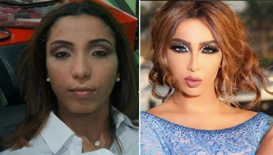 من هي دنيا بطمة وما هو شكلها قبل وبعد التجميل