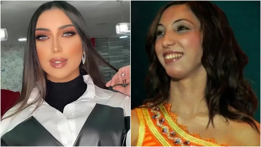 من هي دنيا بطمة وما هو شكلها قبل وبعد التجميل