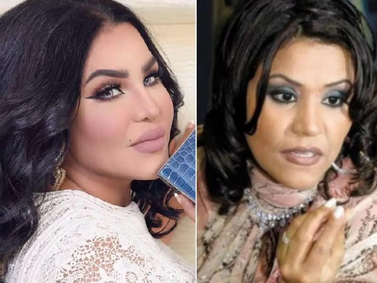 صور فنانات عربيات قبل وبعد عمليات التجميل