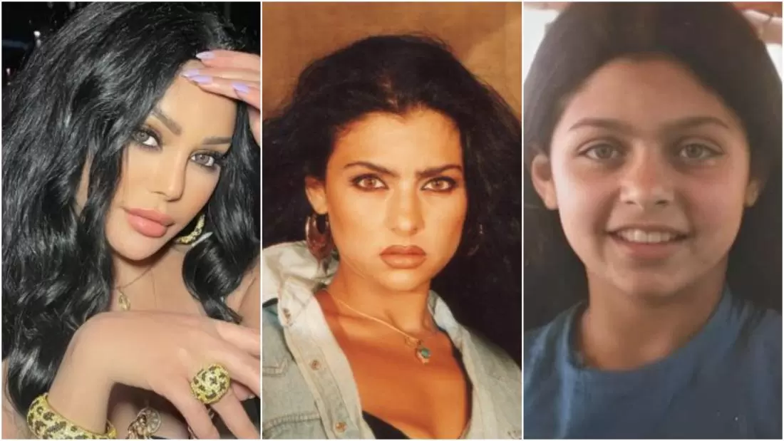 صور فنانات عربيات قبل وبعد عمليات التجميل