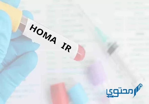 ما هو تحليل HOMA IR