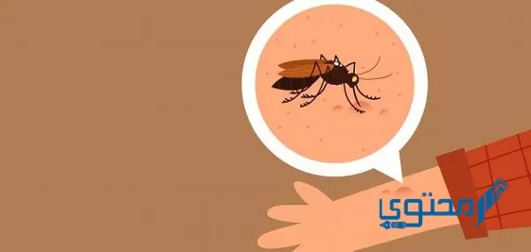 ما هي أسباب الإحساس بحشرات تمشي على الجسم