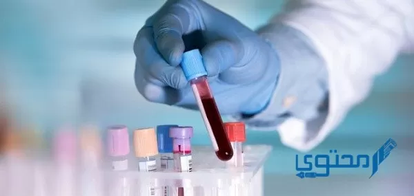 هل تحليل الدم الشامل يكشف الإيدز 