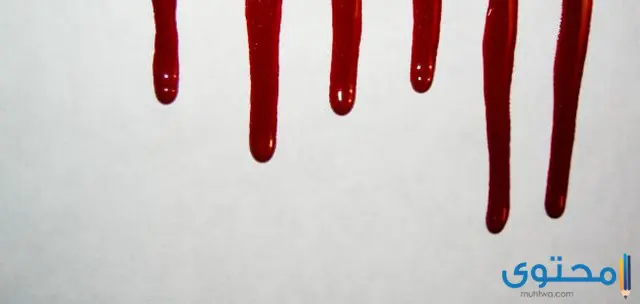 الدم في المنام يخرج من شخص اخر