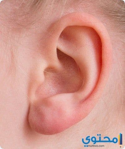  الخرس في المنام