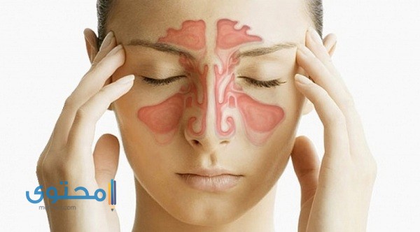 طرق علاج التهاب الجيوب الأنفية نهائياً وأسباب حدوثة 1 أعراض التهاب الجيوب الأنفية
