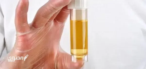 تجربتي مع اختبار الحمل بالكلور بالصور