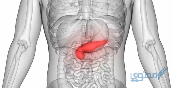 تجربتي مع التهاب البنكرياس