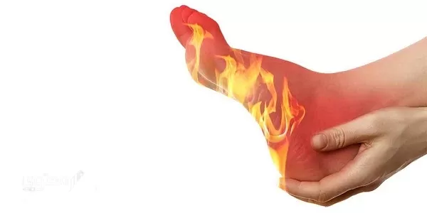 تجربتي مع الفقس في باطن القدم