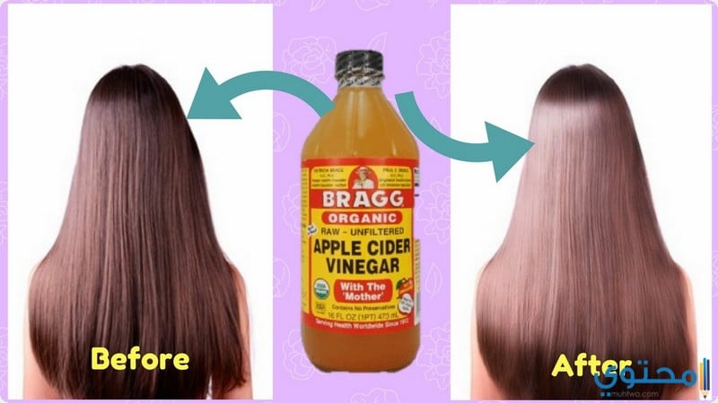 إيجابيات استخدام خل التفاح على الشعر