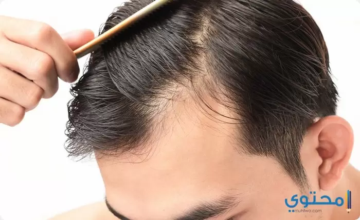 زراعة الشعر في ايران ؛ تكلفة الزراعة وعناوين العيادات