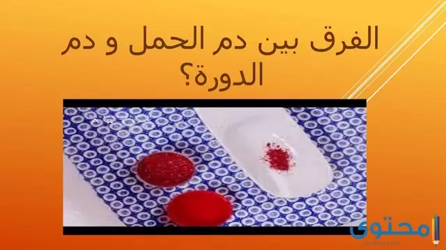 شكل الدم من الحمل