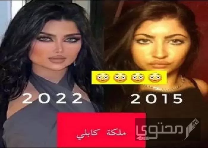 صور ملكة كابلي قبل التجميل وبعده