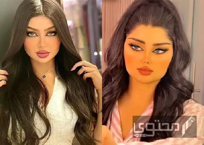 صور ملكة كابلي قبل التجميل وبعده