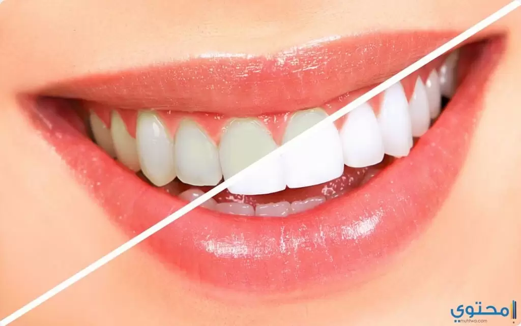 نصائح هامة تجعل أسنانك صحية وناصعة البياض