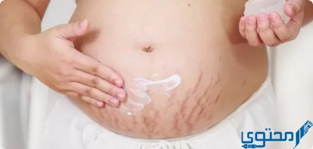 علاج اسمرار الجسم بعد الولادة