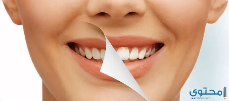 علاج اصفرار الأسنان بـ 9 وصفات للتخلص من اصفرار الأسنان