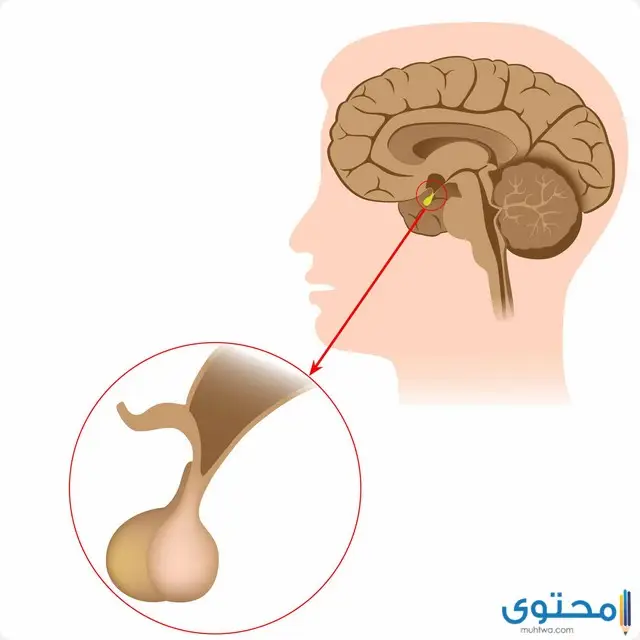 علاج الغدة النخامية