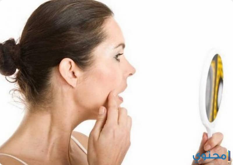 علاج ثآليل الوجه والبشرة والجلد والقدم طبيا