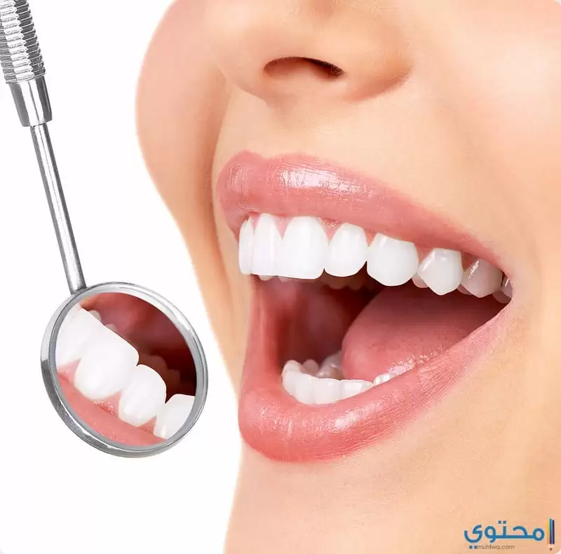 علاج جير الأسنان 3