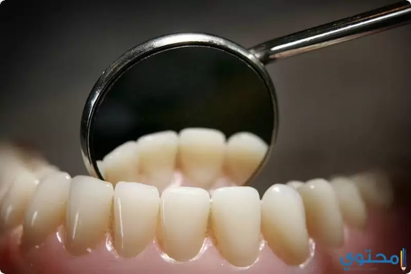 علاج جير الأسنان 5