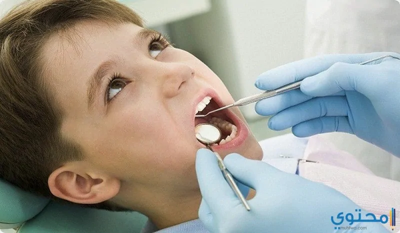 علاج عصب الأسنان 5