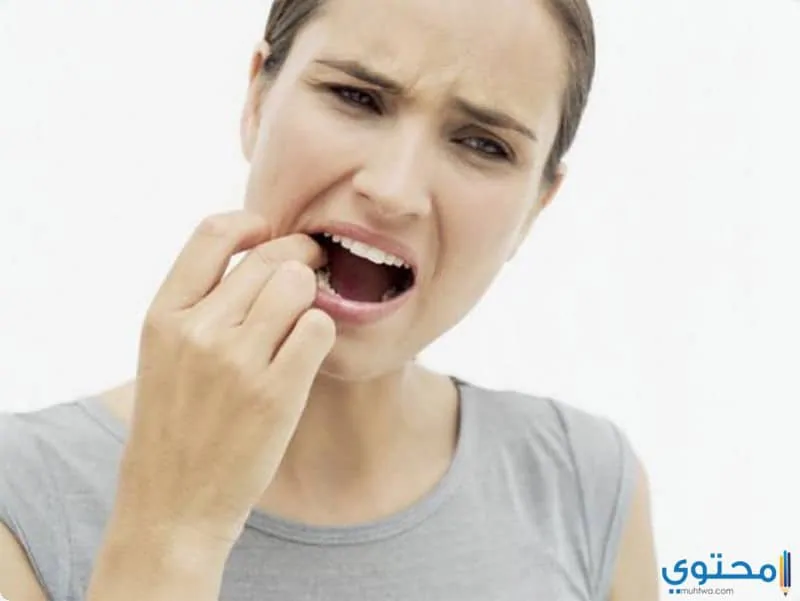 علاج قرحة الفم 1