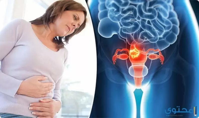 علاج نزيف الرحم بالقرآن2