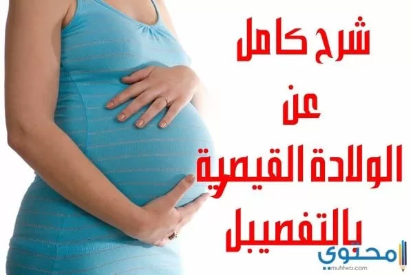 معلومات عن الولادة القيصيرية