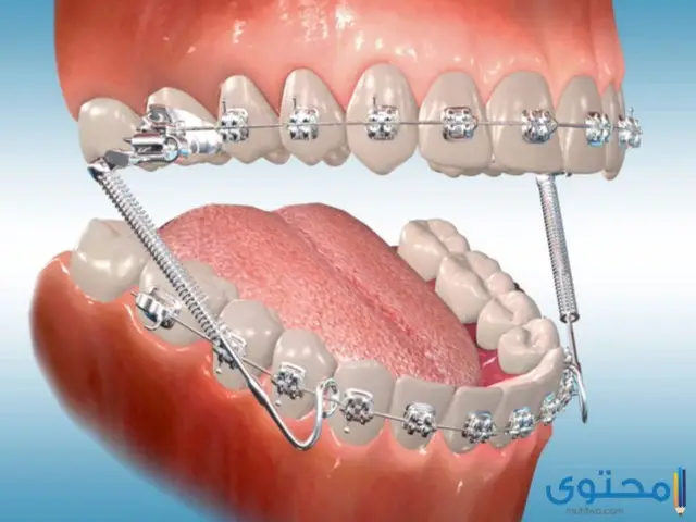 أفضل مستشفى أسنان في الإمارات