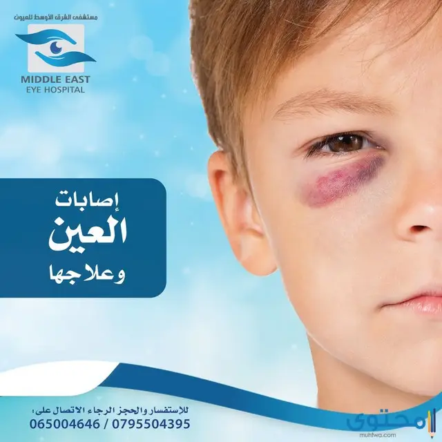 مستشفى عيون في الأردن