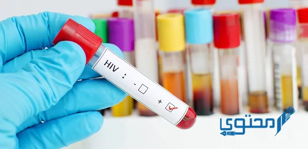 هل تحليل الدم الشامل يكشف الإيدز