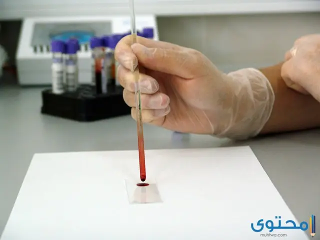 تحليل الدم الرقمي للحمل