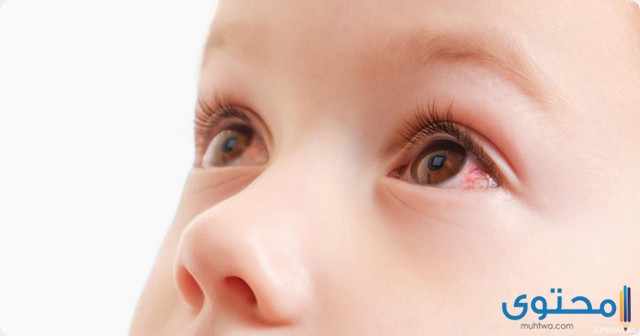 أسباب وجع العين المفاجئ عند الأطفال