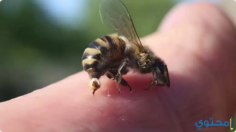 وصفات طبيعية لعلاج لسعة النحلة4
